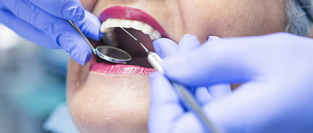 Best Emergency Wisdom Teeth Removal in Ojus, FL